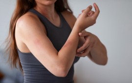 טיפולים חדשניים באקזמה: מנגנוני התרחשות וגישות טיפוליות אילוסטרציה (freepik)